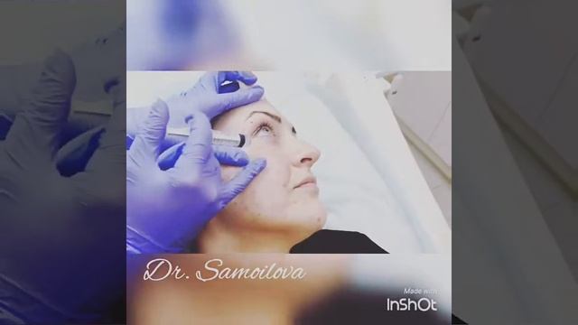 Мезотерапия "Сияние кожи" и "Худое лицо " смотреть онлайн