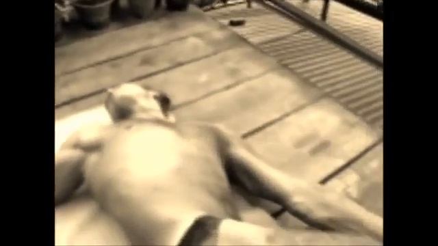 Лечение межпозвоночных грыж  Поясничный отдел