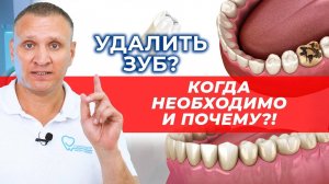 Удаление зуба: в каких случаях это необходимо и почему?!