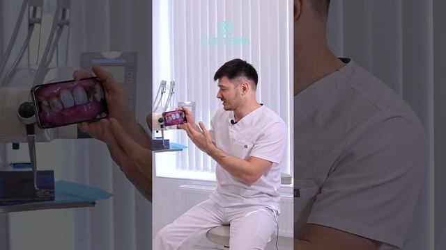 До/после профессиональной гигиены Зубов