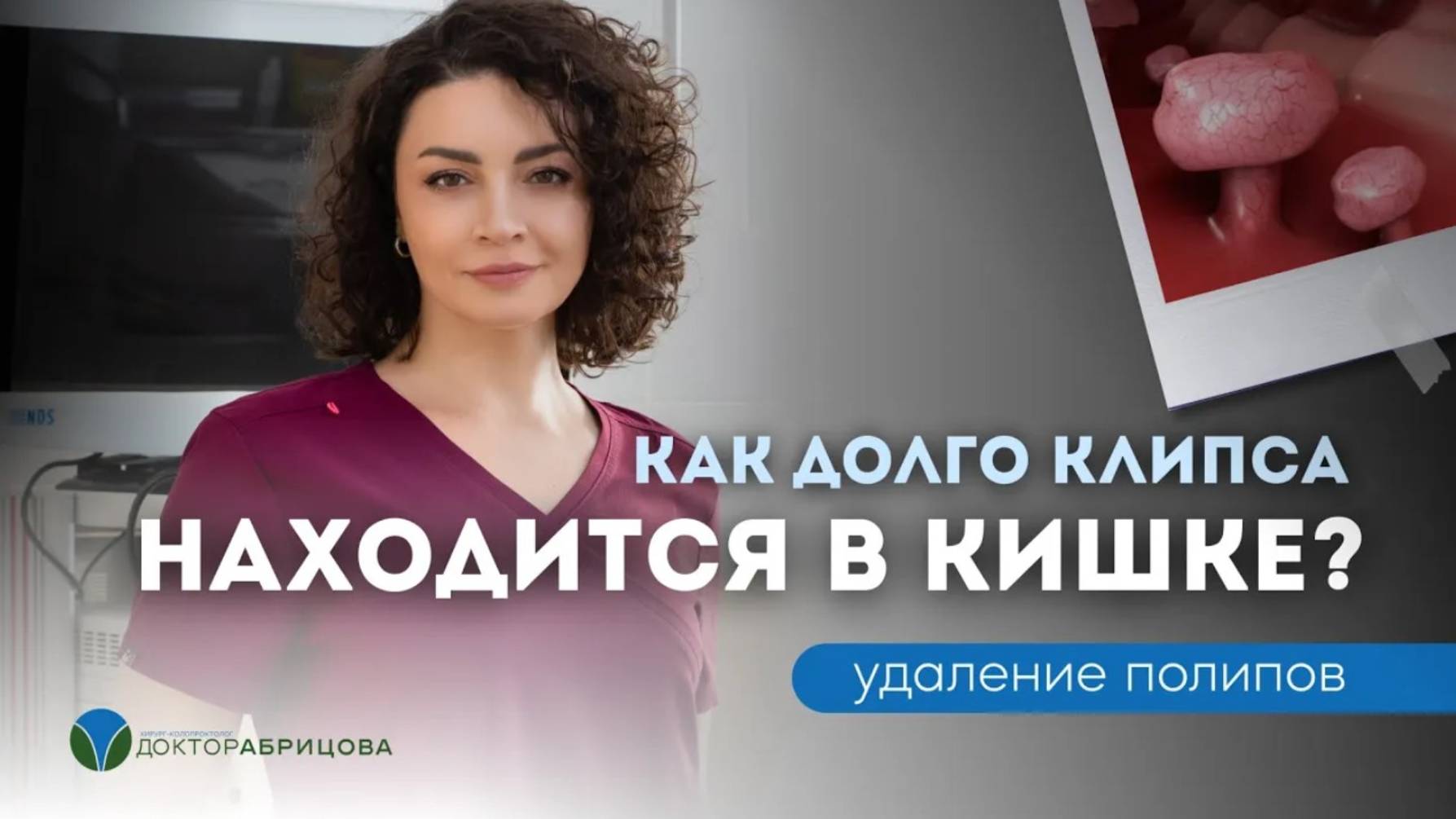 Как долго эндоскопические клипсы остаются в кишке?