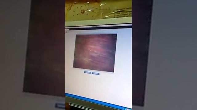 Гистология Плацента