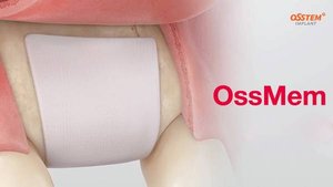 OssMem. Резорбируемая мембрана