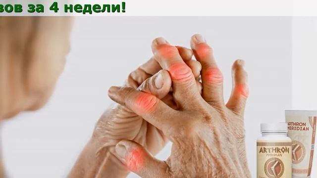Arthron Meridian Что Это Такое, Применение, Купить, Отзывы