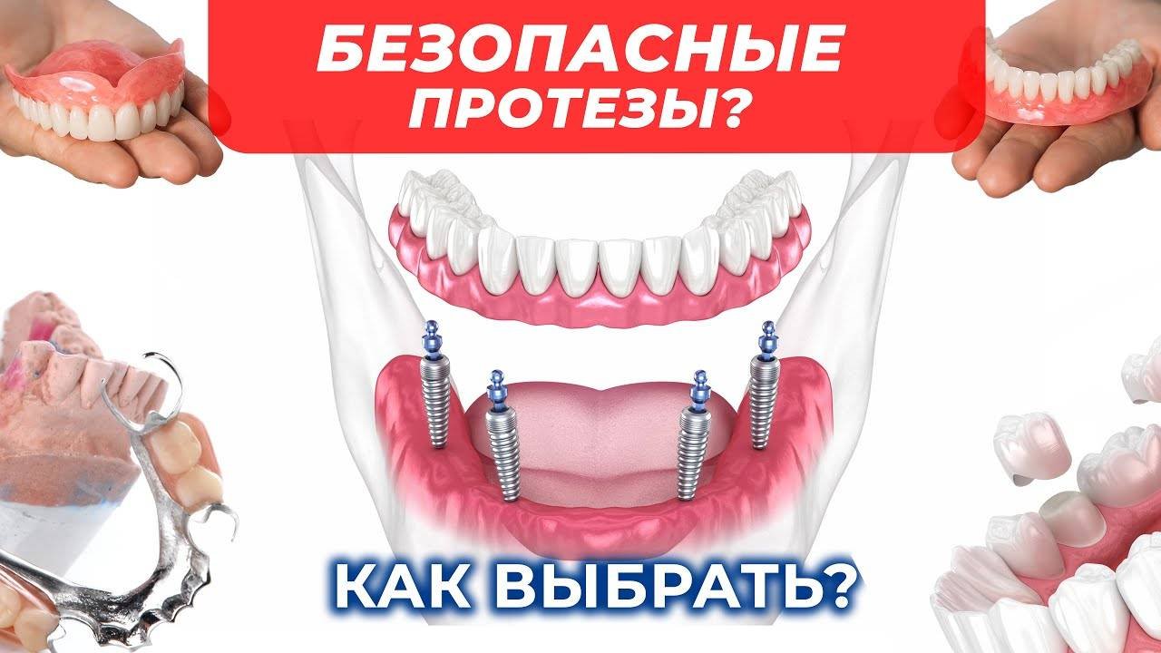 Как выбрать безопасные протезы? Советы эксперта!