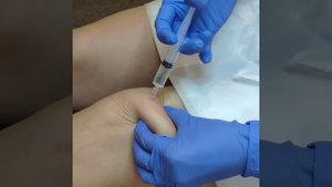 введение прямых липолитиков