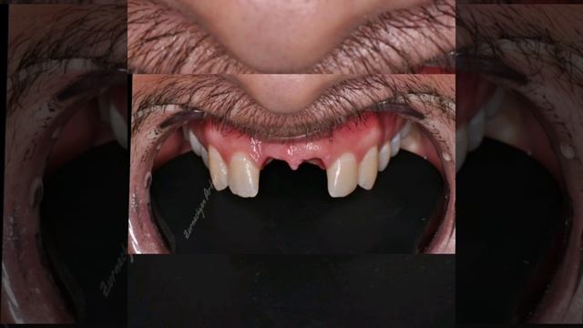 Зурначя Артур Арамович смотреть онлайн