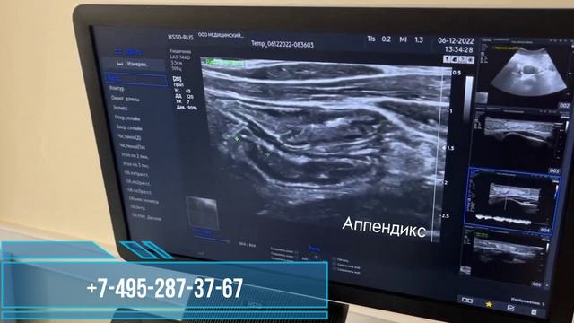 узи на автозаводцкой