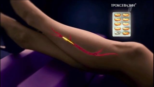 (2015) ТРОКСЕВАЗИН - Шаг вперед к лечению варикоза смотреть онлайн