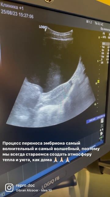 Перенос эмбриона женщине самый волшебный этап… #эко #repro_doc #эндометрий #беременностьэко