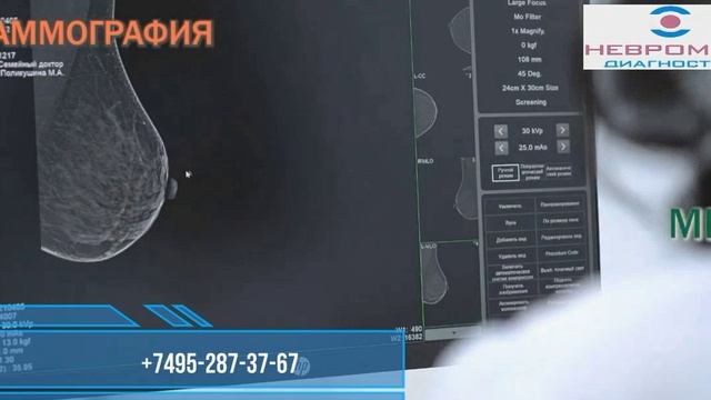 мамография