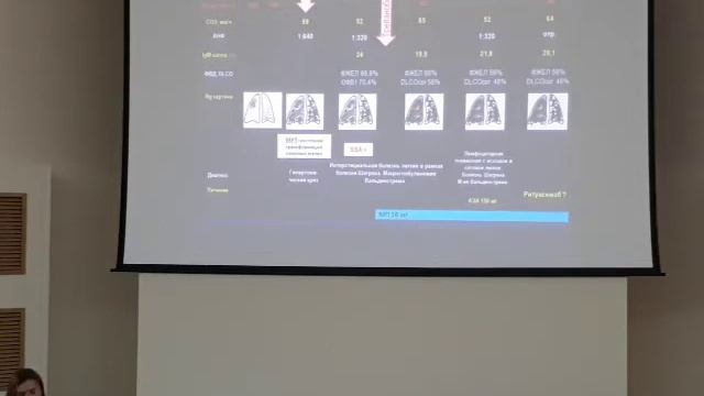 Лимфоцитарная пневмония, Макроглобултнемия Вальденстрема и болезнь Шегрена у мужчины