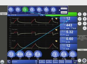 Симулятор АВЕНТА А_С-CMV вдохи Asiist и Control (Л.№6) Горячев А.С