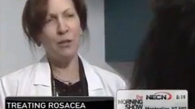 CANDELA Vbeam 595 nm Pulsed Dye Lazer ile Rosacea Tedavisi Dr. Ruth Tedaldi смотреть онлайн