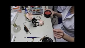 Изготовление бюгельного протеза из базисного материала Нолатек