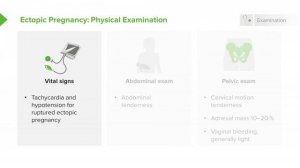 2.07 Ectopic Pregnancy- Examination