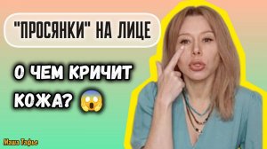 "Просянки" на лице: о чем кричит кожа? 😱 Зима с Машей ❄️ Видео №54