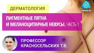 Профессор Красносельских Т.В.: Пигментные пятна и меланоцитарные невусы. Часть 1