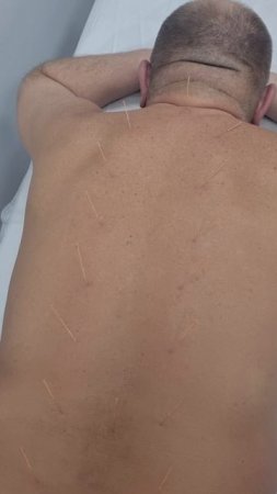 боль в спине. лечение.