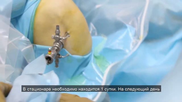 Клиника Константа. Артроскопия. Вопрос/ответ. Ортопед-травматолог Катамадзе К.Б. смотреть онлайн