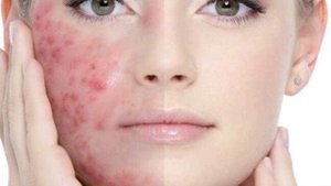 АДАМНЫҢ ЖҮЗІ  – ІШКІ АҒЗАНЫҢ АЙНАСЫ. АДАМНЫҢ бетіндегі ӨЗГЕРІСТЕР нені аңғартады?