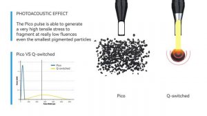 Picosecond Laser VS Q Switched Laser