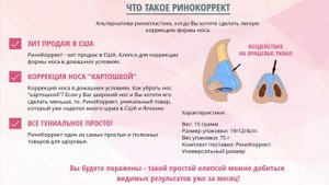 РиноКоррект - безоперационная ринопластика
