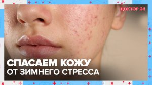 Спасаем КОЖУ от ЗИМНЕГО СТРЕССА! ТЕМЫ НЕДЕЛИ | Доктор 24