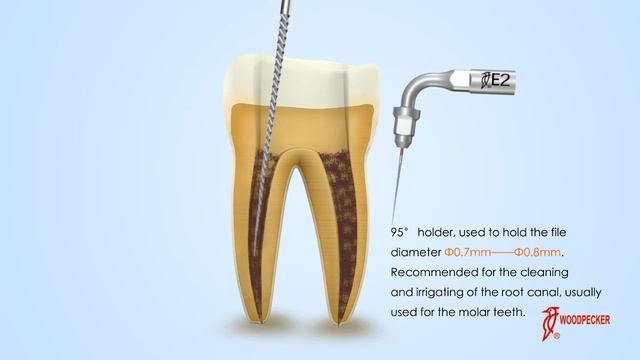 Woodpecker TIPS E2 смотреть онлайн