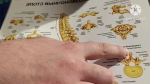 безоперационное лечение стеноза спинномозгового канала, фораминального стеноза