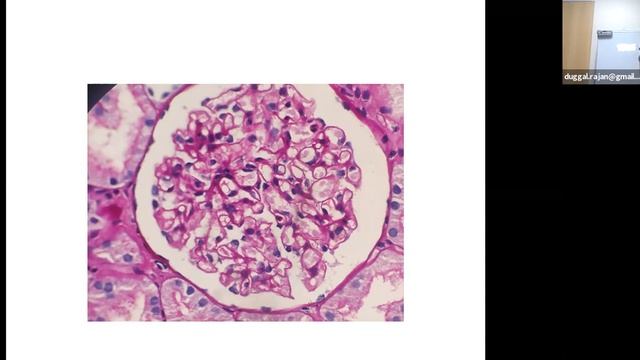 8th July 2021 Dr. Rajan Duggal: Case Study смотреть онлайн