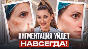 САМЫЕ эффективные способы удаления пигментации! / Как ИЗБАВИТЬСЯ от пигментных пятен?