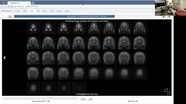 DEMO: Hyperfine Portable MRI