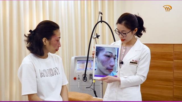 Trị u máu bằng Công nghệ laser Vbeam tại TM Hoàng Tuấn смотреть онлайн