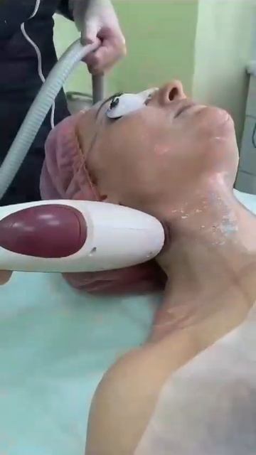 Всесезонное лазерное омоложение на инновационном лазере RUIKD LAMIS XL смотреть онлайн