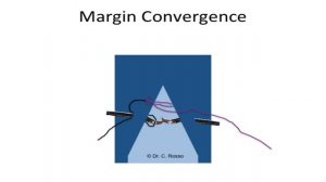 Margin Convergence in Arthroscopic Rotator Cuff Repair