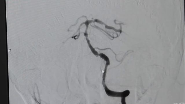 Отзыв о клинике «Uniserv Medical Center» смотреть онлайн