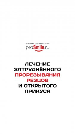 Лечение открытого прикуса. Работа врача-ортодонта Фомцовой К.К.