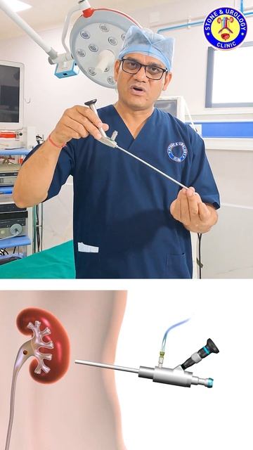 What is Mini  Nephroscope?  PCNL/ Mini PCNL क्या है ?  Dr Raj Kr Sharma