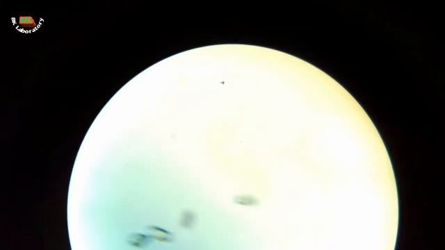 Triple Phosphate Crystal to seen the urine slide смотреть онлайн