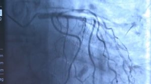 Эндоваскулярная хирургия