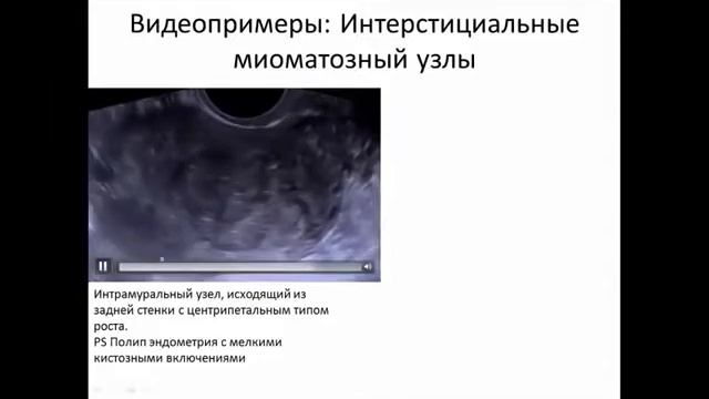 Нет на основном канале 1026 3 в/п смотреть онлайн