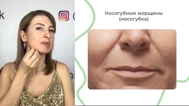 Носогубка и прикус. Морщины марионетки