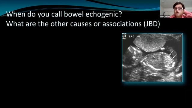 Aberrant Right Subclavian Artery смотреть онлайн