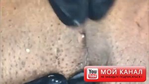 Relax squeezing out blackheads #62 Черные точки
