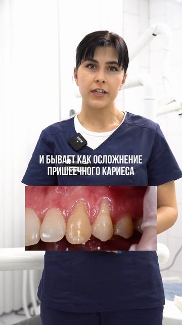 Рецессия десны #стоматология #полезно #зубы #брекеты #виниры #зубыдоипосле #dentist #каклечить #соч