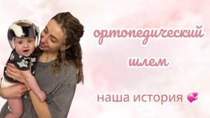 ОРТОПЕДИЧЕСКИЙ ШЛЕМ // НАША ИСТОРИЯ // ПЛАГИОЦЕФАЛИЯ
