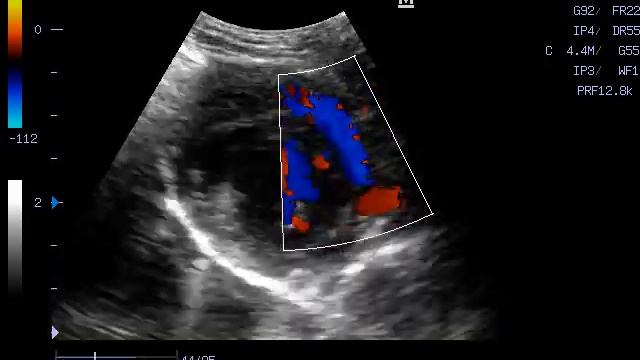 201206142043250020 смотреть онлайн