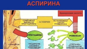 Лечение инфаркта миокарда часть I Кошкина Е. В.