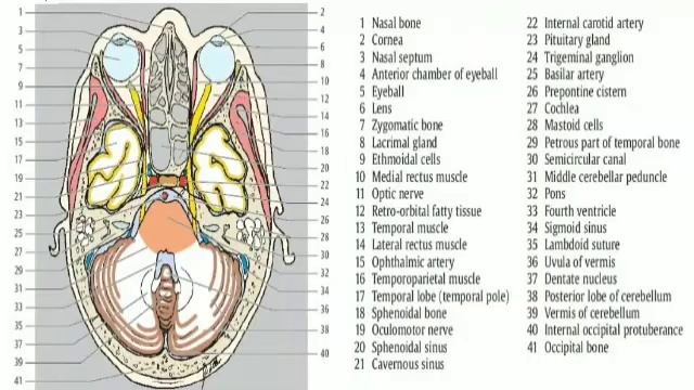 Anatomy of brain on CT and MRI / Coloured pictures / Part 2